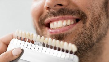 Dental Veneers Appropriate Restorations for Damaged Teeth